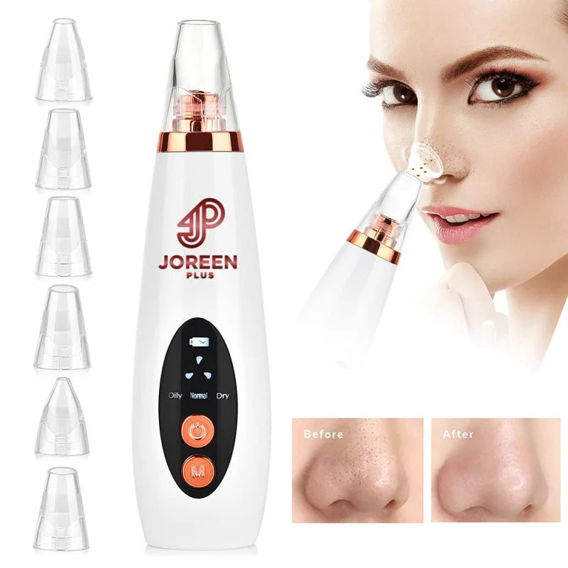 Electric Blackhead Remover Vacuum