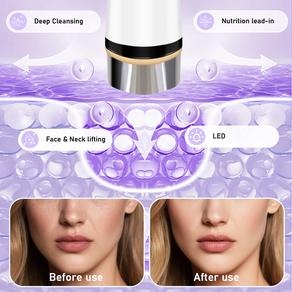 Microcurrent Facial Toning Device